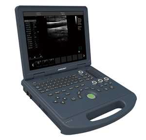 筆記本式全數字彩色多普勒超聲診斷
