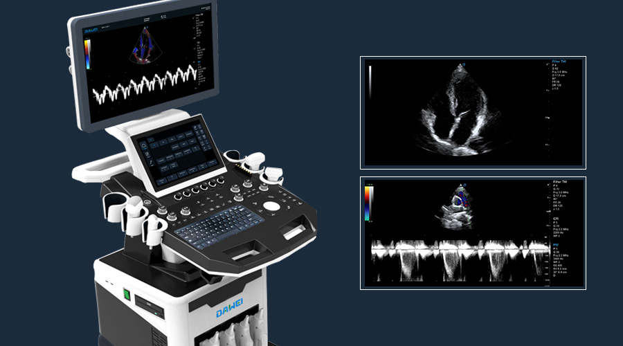 推車(chē)式彩超機(jī)