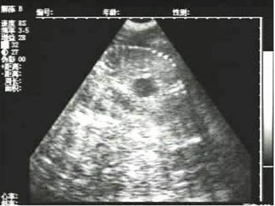 獸用B超機(jī)檢測(cè)母豬胎兒骨骼圖像